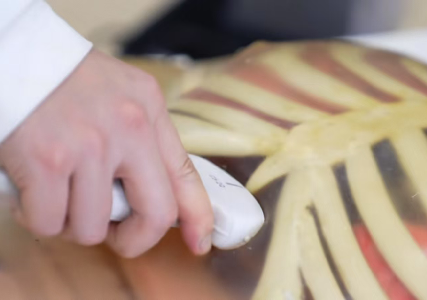 综合超声检查平台2.0